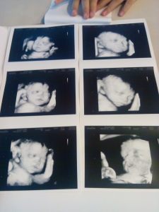 He looks like his dad :)